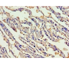 Immunohistochemistry - Gastric intrinsic factor Polyclonal Antibody from Signalway Antibody (42180) - Antibodies.com