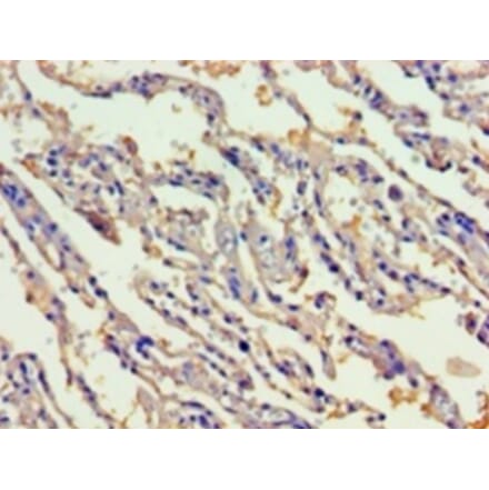 Immunohistochemistry - Gastric intrinsic factor Polyclonal Antibody from Signalway Antibody (42180) - Antibodies.com