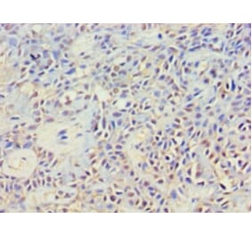 Immunohistochemistry - Cytoplasmic protein NCK2 Polyclonal Antibody from Signalway Antibody (42268) - Antibodies.com