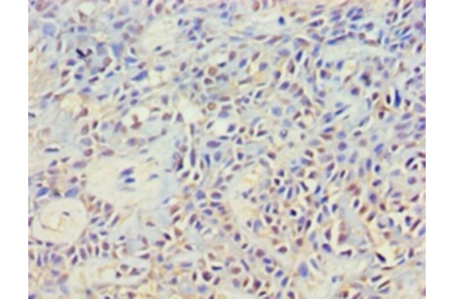 Immunohistochemistry - Cytoplasmic protein NCK2 Polyclonal Antibody from Signalway Antibody (42268) - Antibodies.com