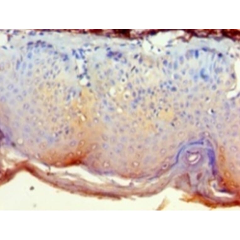 Immunohistochemistry - Cytoplasmic protein NCK2 Polyclonal Antibody from Signalway Antibody (42268) - Antibodies.com