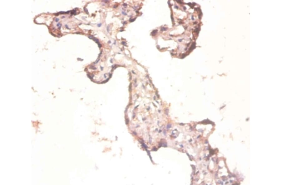 Immunohistochemistry - 60S ribosomal protein L3 Polyclonal Antibody from Signalway Antibody (42347) - Antibodies.com