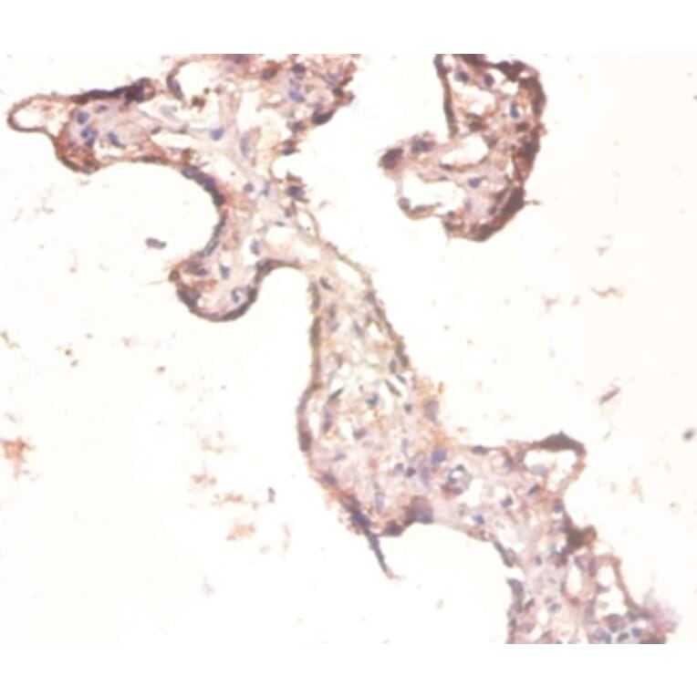 Immunohistochemistry - 60S ribosomal protein L3 Polyclonal Antibody from Signalway Antibody (42347) - Antibodies.com