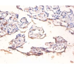 Immunohistochemistry - Transcription factor p65 Polyclonal Antibody from Signalway Antibody (42406) - Antibodies.com