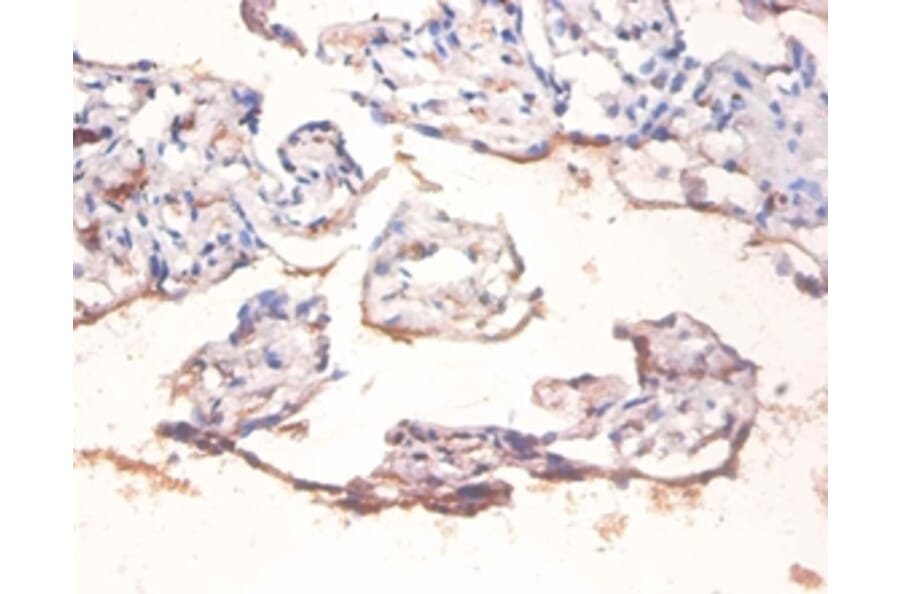 Immunohistochemistry - Transcription factor p65 Polyclonal Antibody from Signalway Antibody (42406) - Antibodies.com