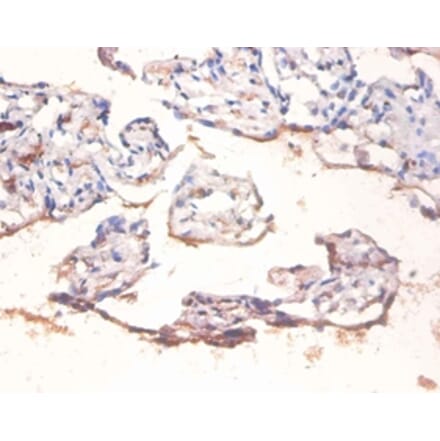 Immunohistochemistry - Transcription factor p65 Polyclonal Antibody from Signalway Antibody (42406) - Antibodies.com