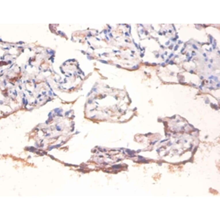 Immunohistochemistry - Transcription factor p65 Polyclonal Antibody from Signalway Antibody (42406) - Antibodies.com
