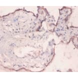 Immunohistochemistry - 78 kDa glucose-regulated Polyclonal Antibody from Signalway Antibody (42420) - Antibodies.com