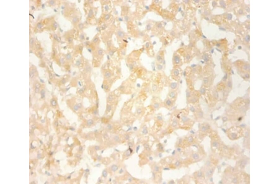 Immunohistochemistry - C-X-C motif chemokine 13 Polyclonal Antibody from Signalway Antibody (42450) - Antibodies.com