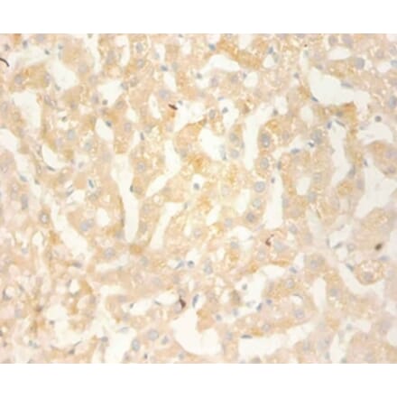 Immunohistochemistry - C-X-C motif chemokine 13 Polyclonal Antibody from Signalway Antibody (42450) - Antibodies.com
