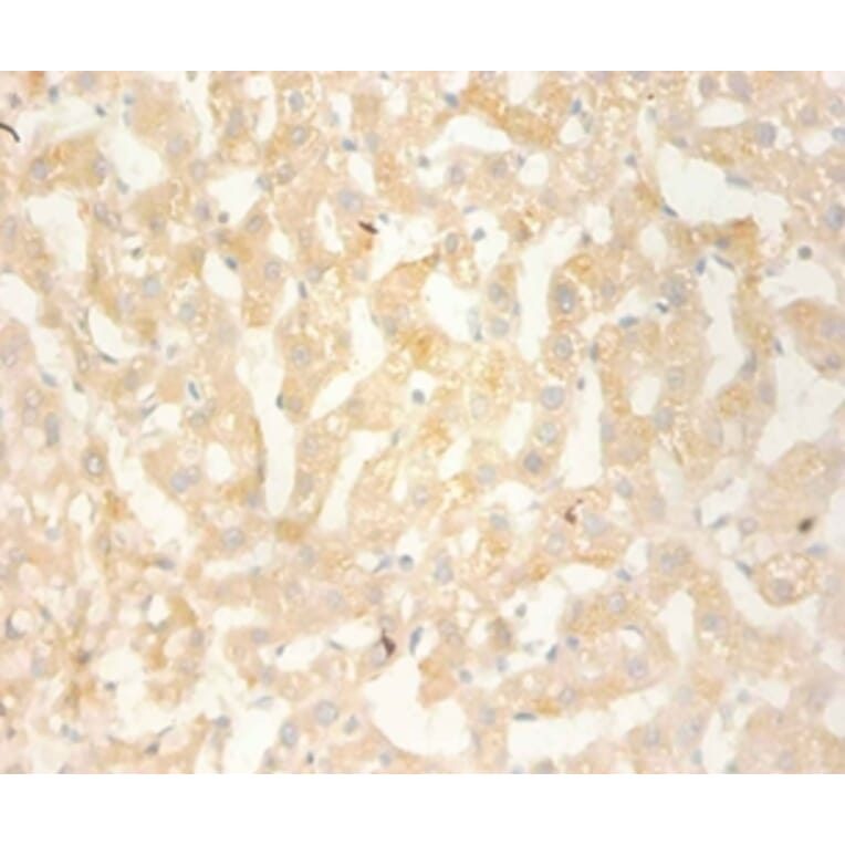 Immunohistochemistry - C-X-C motif chemokine 13 Polyclonal Antibody from Signalway Antibody (42450) - Antibodies.com