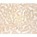 Immunohistochemistry - C-X-C motif chemokine 13 Polyclonal Antibody from Signalway Antibody (42450) - Antibodies.com