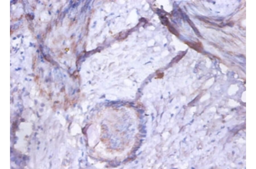 Immunohistochemistry - Golgi membrane protein 1 Polyclonal Antibody from Signalway Antibody (42527) - Antibodies.com