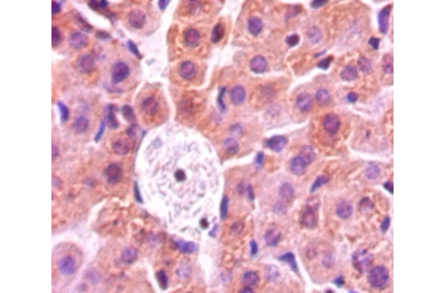 Immunohistochemistry - Protein-lysine 6-oxidase Polyclonal Antibody from Signalway Antibody (42608) - Antibodies.com