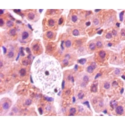 Immunohistochemistry - Protein-lysine 6-oxidase Polyclonal Antibody from Signalway Antibody (42608) - Antibodies.com