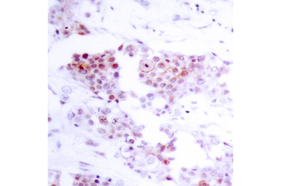Immunohistochemistry - MEF2a (Ab-319) Antibody from Signalway Antibody (21040) - Antibodies.com
