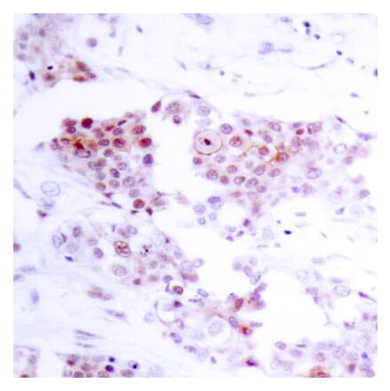 Immunohistochemistry - MEF2a (Ab-319) Antibody from Signalway Antibody (21040) - Antibodies.com