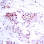 Immunohistochemistry - MEF2a (Ab-319) Antibody from Signalway Antibody (21040) - Antibodies.com