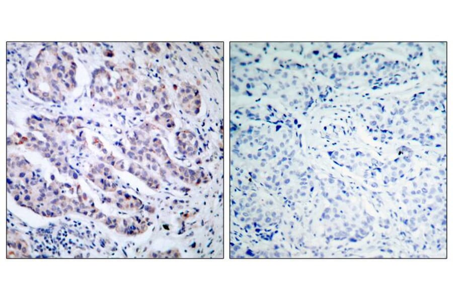 Immunohistochemistry - TYK2 (Ab-1054) Antibody from Signalway Antibody (21118) - Antibodies.com