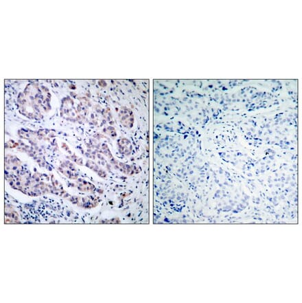 Immunohistochemistry - TYK2 (Ab-1054) Antibody from Signalway Antibody (21118) - Antibodies.com