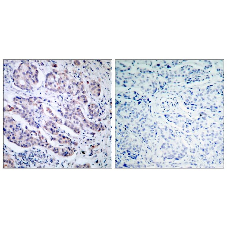 Immunohistochemistry - TYK2 (Ab-1054) Antibody from Signalway Antibody (21118) - Antibodies.com