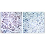 Immunohistochemistry - TYK2 (Ab-1054) Antibody from Signalway Antibody (21118) - Antibodies.com