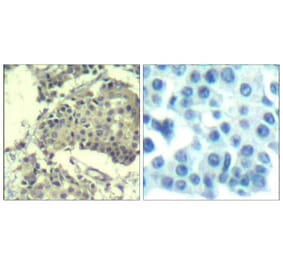 Immunohistochemistry - mTOR (Ab-2481) Antibody from Signalway Antibody (21515) - Antibodies.com