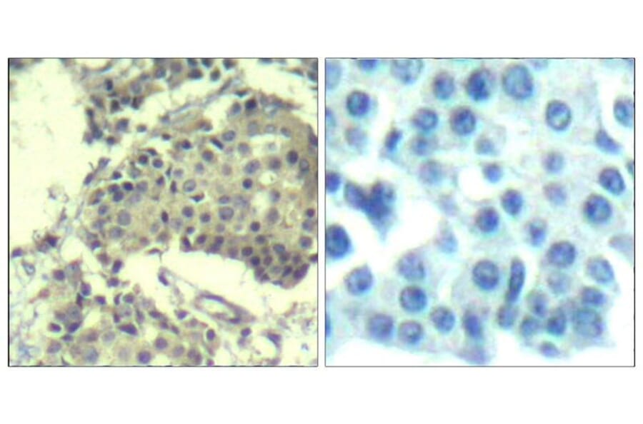 Immunohistochemistry - mTOR (Ab-2481) Antibody from Signalway Antibody (21515) - Antibodies.com