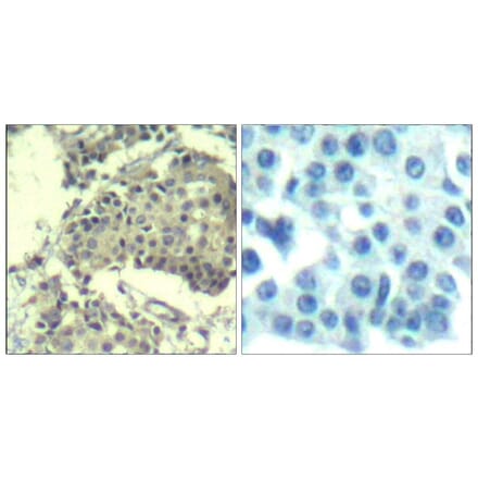 Immunohistochemistry - mTOR (Ab-2481) Antibody from Signalway Antibody (21515) - Antibodies.com