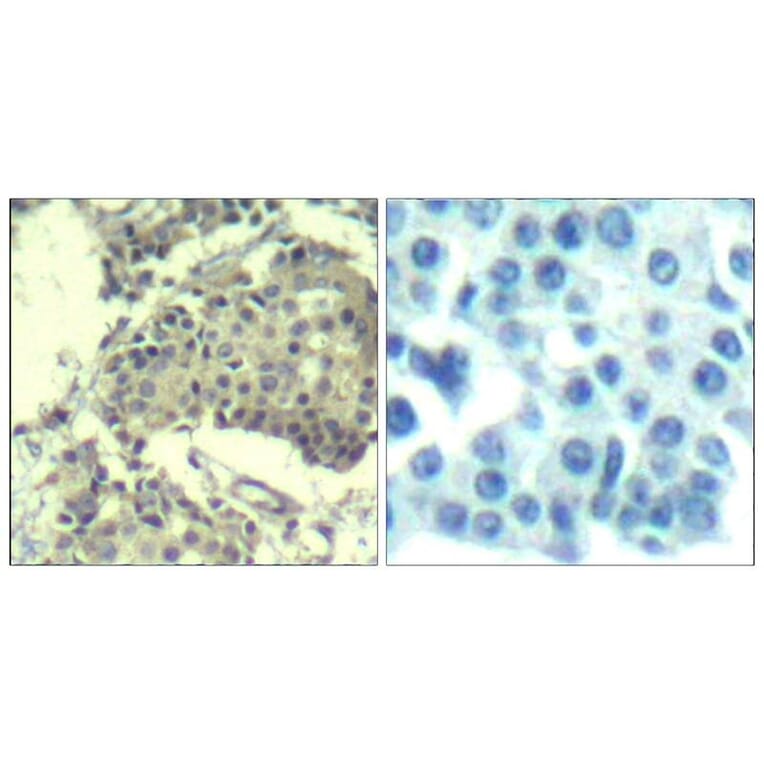 Immunohistochemistry - mTOR (Ab-2481) Antibody from Signalway Antibody (21515) - Antibodies.com