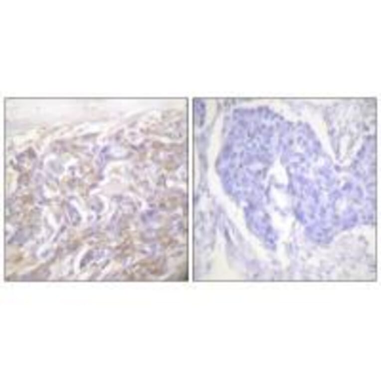 Immunohistochemistry - TNF Receptor-1 Antibody from Signalway Antibody (33527) - Antibodies.com