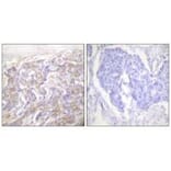 Immunohistochemistry - TNF Receptor-1 Antibody from Signalway Antibody (33527) - Antibodies.com