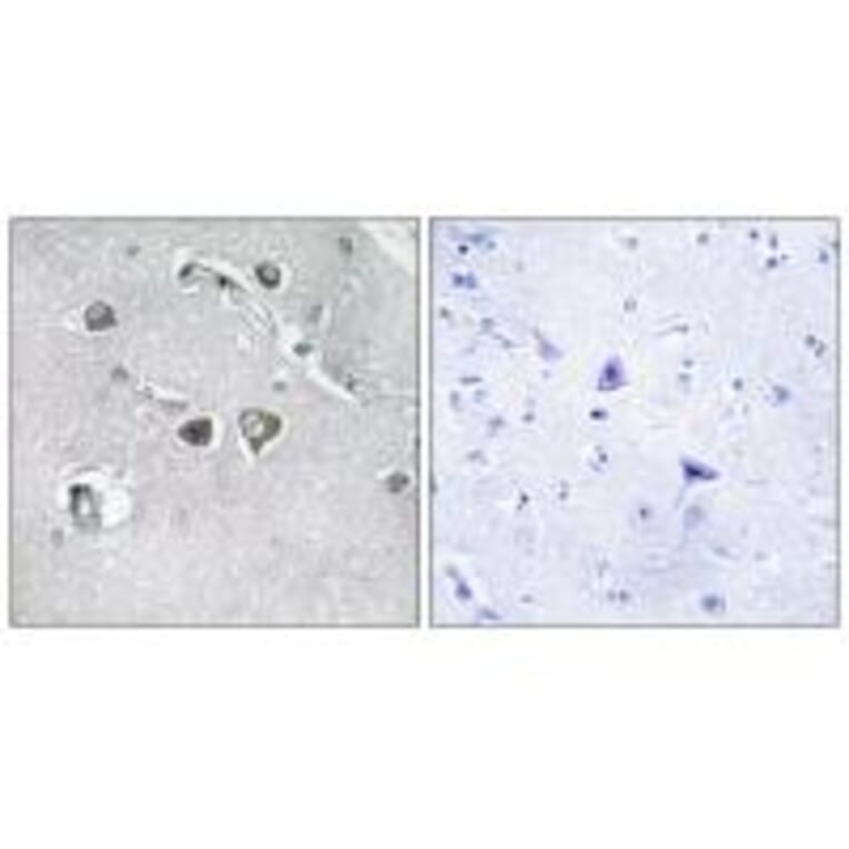 Immunohistochemistry - Collagen XI α2 Antibody from Signalway Antibody (34212) - Antibodies.com