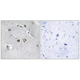 Immunohistochemistry - Collagen XI α2 Antibody from Signalway Antibody (34212) - Antibodies.com