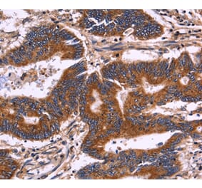 Immunohistochemistry - KIR2DL3/1/4/S4 Antibody from Signalway Antibody (36321) - Antibodies.com