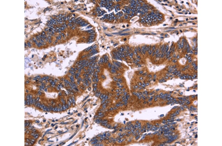 Immunohistochemistry - KIR2DL3/1/4/S4 Antibody from Signalway Antibody (36321) - Antibodies.com