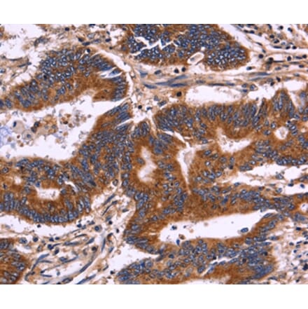 Immunohistochemistry - KIR2DL3/1/4/S4 Antibody from Signalway Antibody (36321) - Antibodies.com