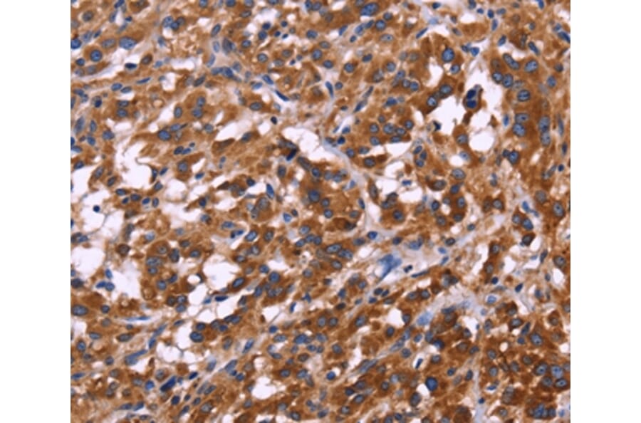 Immunohistochemistry - KIR2DL3/1/4/S4 Antibody from Signalway Antibody (36321) - Antibodies.com