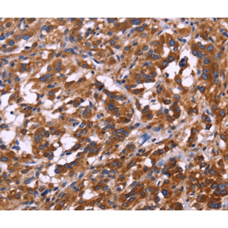Immunohistochemistry - KIR2DL3/1/4/S4 Antibody from Signalway Antibody (36321) - Antibodies.com