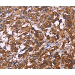 Immunohistochemistry - KIR2DL3/1/4/S4 Antibody from Signalway Antibody (36321) - Antibodies.com