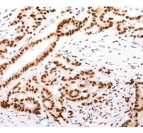 Immunohistochemistry - CASP9 (active) Antibody from Signalway Antibody (37307) - Antibodies.com