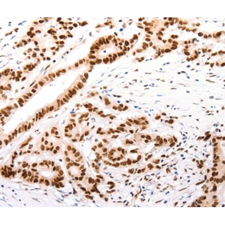 Immunohistochemistry - CASP9 (active) Antibody from Signalway Antibody (37307) - Antibodies.com