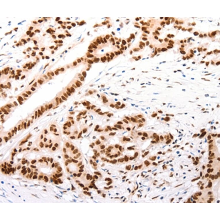 Immunohistochemistry - CASP9 (active) Antibody from Signalway Antibody (37307) - Antibodies.com