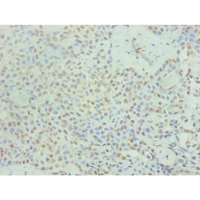 Immunohistochemistry - PRL Monoclonal Antibody from Signalway Antibody (42025) - Antibodies.com