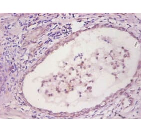 Immunohistochemistry - IL6 Monoclonal Antibody from Signalway Antibody (42035) - Antibodies.com