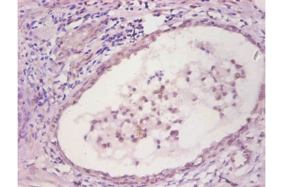 Immunohistochemistry - IL6 Monoclonal Antibody from Signalway Antibody (42035) - Antibodies.com