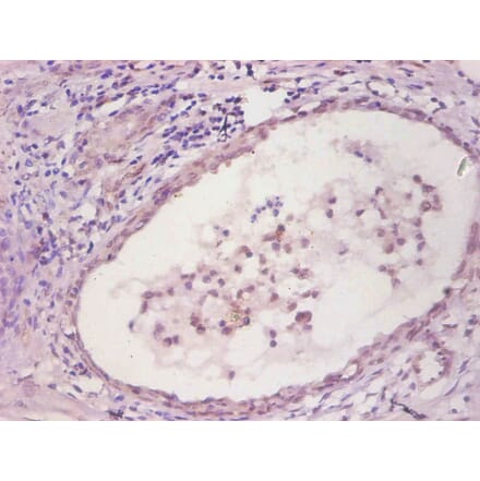 Immunohistochemistry - IL6 Monoclonal Antibody from Signalway Antibody (42035) - Antibodies.com