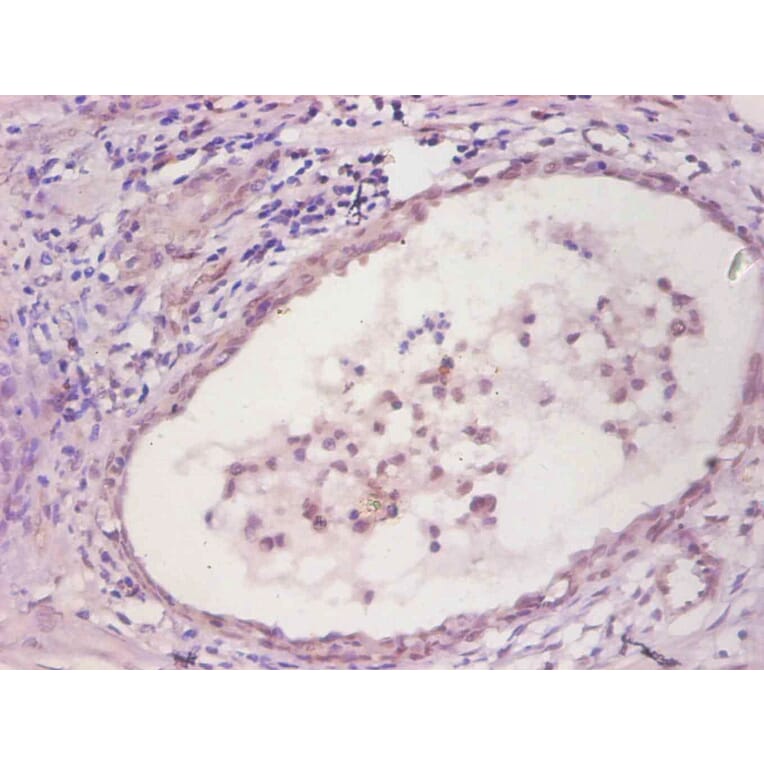 Immunohistochemistry - IL6 Monoclonal Antibody from Signalway Antibody (42035) - Antibodies.com