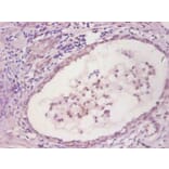 Immunohistochemistry - IL6 Monoclonal Antibody from Signalway Antibody (42035) - Antibodies.com