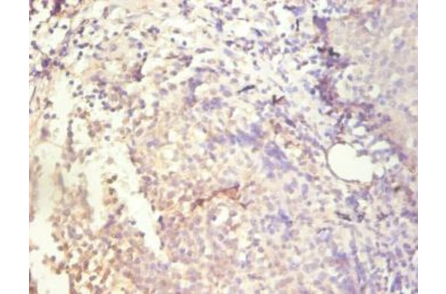 Immunohistochemistry - IL8 Monoclonal Antibody from Signalway Antibody (42041) - Antibodies.com